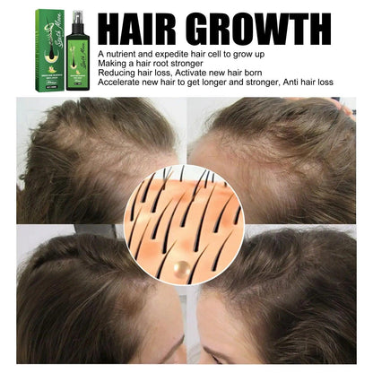 Hair Growth Nourishing Spray