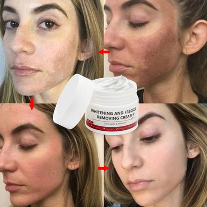 Whitening Freckle Cream