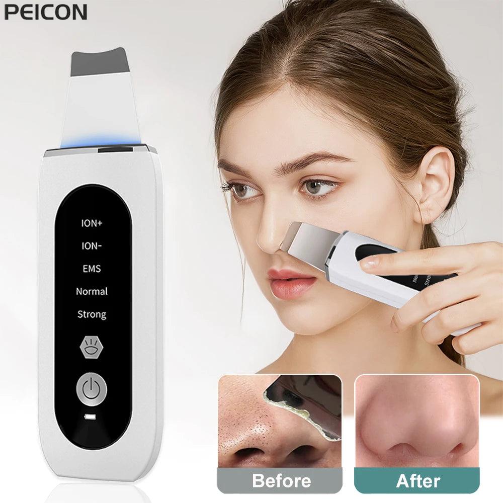 Ultrasonic Skin Scrubber