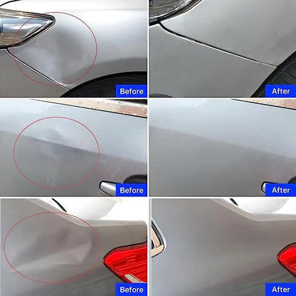 Paintless Dent Repair Kit – Auto Hail Removal Suction Cup Set