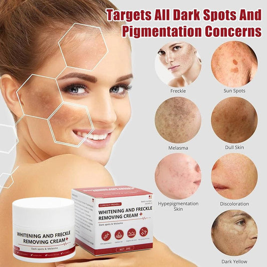 Whitening Freckle Cream